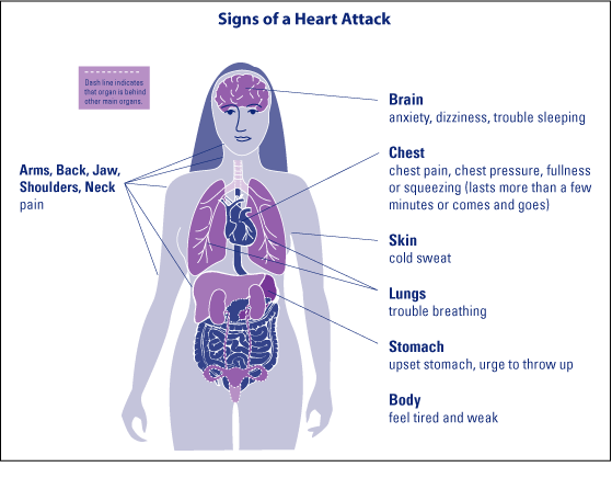 signs of a heart attach diagram